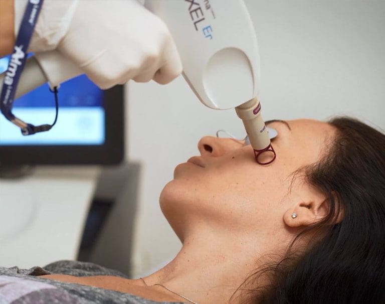 A Woman getting Pixel Resurfacing treatment on cheeks | Original Skin Face + Body in Plano TX
