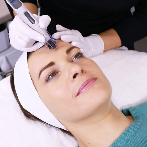 A Woman getting Dermafrac treatment | Original Skin Face + Body in Plano TX